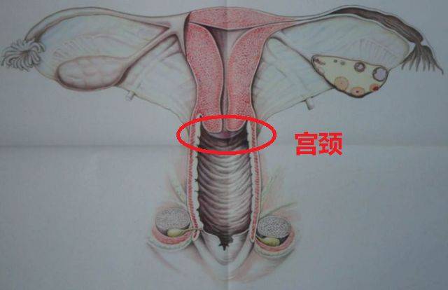 宫颈长在什么位置图片图片