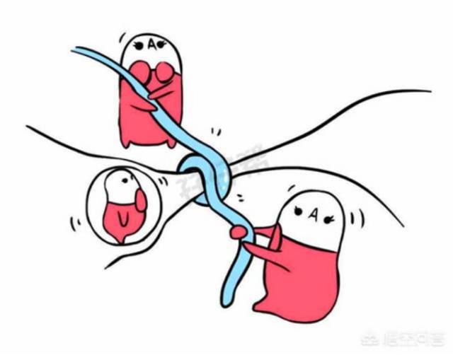 但是这可是人生大事啊, 结扎意味着输卵管要被切除掉,意味着以后都没