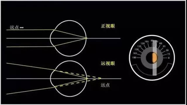 视盘的位置图片