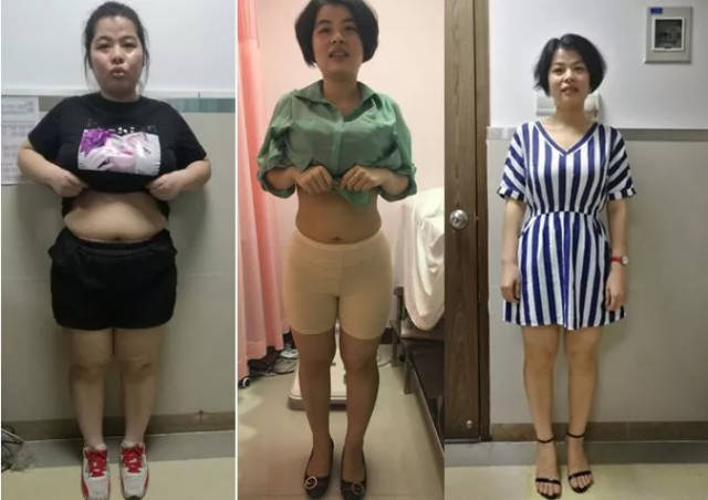 170斤姑娘减肥,医生却让她多吃肉!结果瘦了55斤,餐单曝光