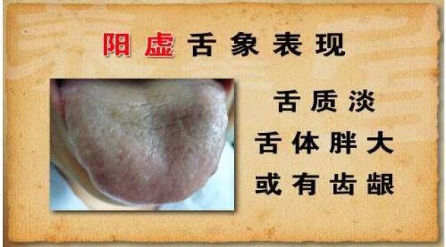 耳鸣,头晕目眩,没精神,口干舌燥,大便干结,遗精,舌苔偏红,精神萎缩