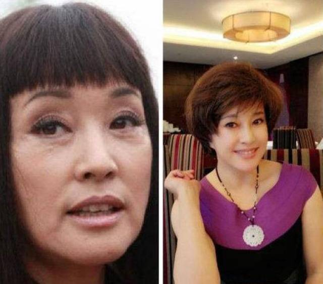 拉皮整容装嫩,网络上也有不少刘晓庆满脸褶皱的照片和脸似少女的对比