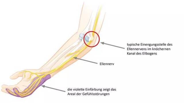 手肘麻筋位置图解图片
