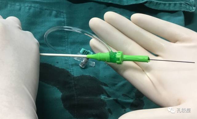 一文掌握 | 手把手教你桡动脉穿刺技巧(精美图文)