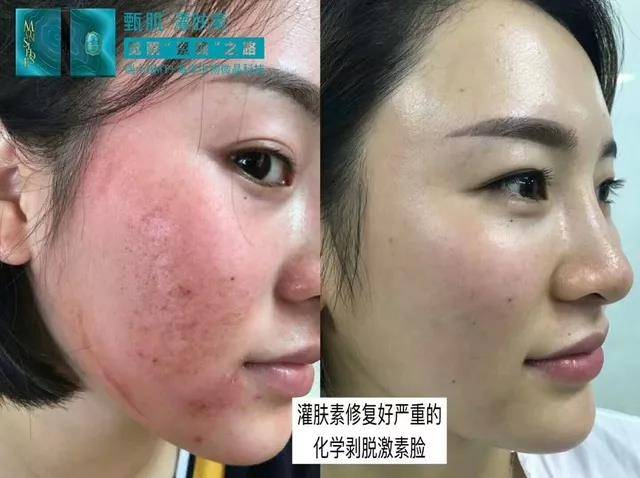 医学级护肤：引领美丽新风尚