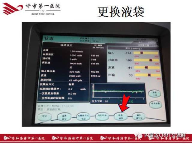 图解crrt治疗全过程,一看保证能学会(金宝)!