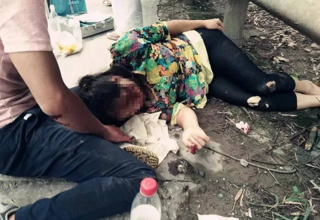 泸州女子因车祸生命垂危民警警车超速开道送抢救