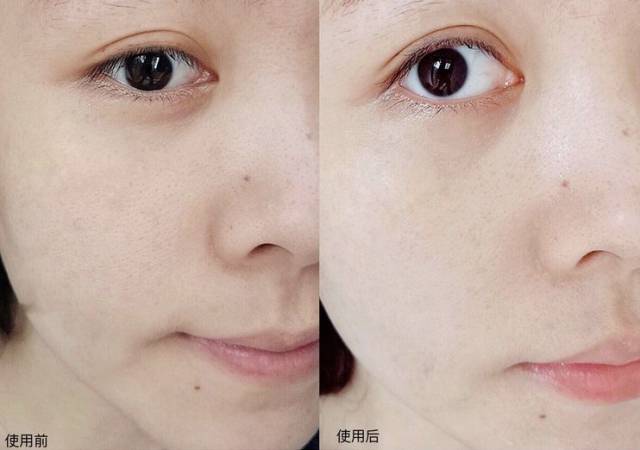 湿敷2分钟前后对比 作为"国民精华", 足足120ml的大容量比起30ml的