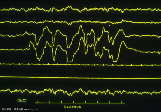 永不消逝的电波:意识的波动