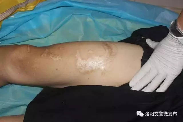 洛阳交警发布「认尸启事」!请大家积极转发,扩散!