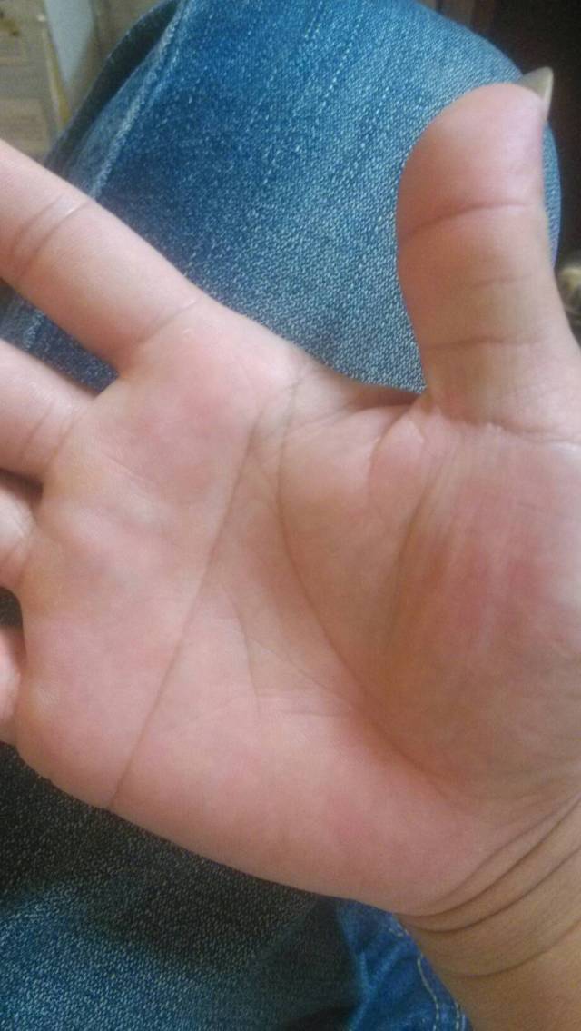 男儿断掌千斤两,女子断掌过房养,断掌大解析!