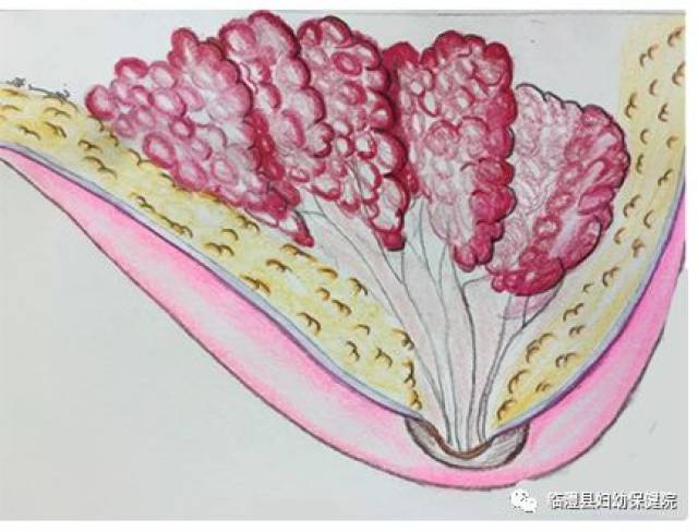 它们产生的乳汁沿着乳管(树枝)传送,乳管在乳晕(乳头周围的暗色区域)