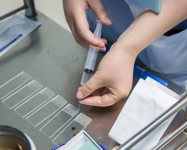 甲状腺细针穿刺活检术是当前应用于甲状腺疾病诊断的最有效技术,同时