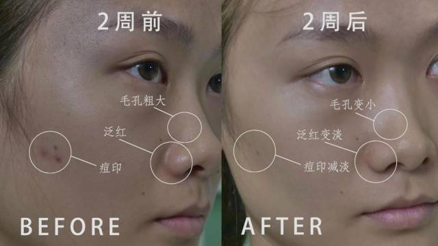 干燥泛红精华