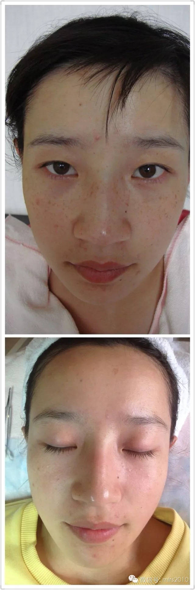 手机辐射会长斑吗