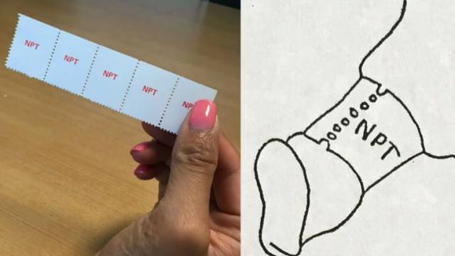 这种邮票测试法已经成为有无夜间自发勃起的主要检测方法啦!