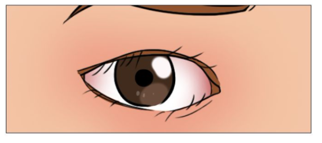 眼睛异物感分为两类