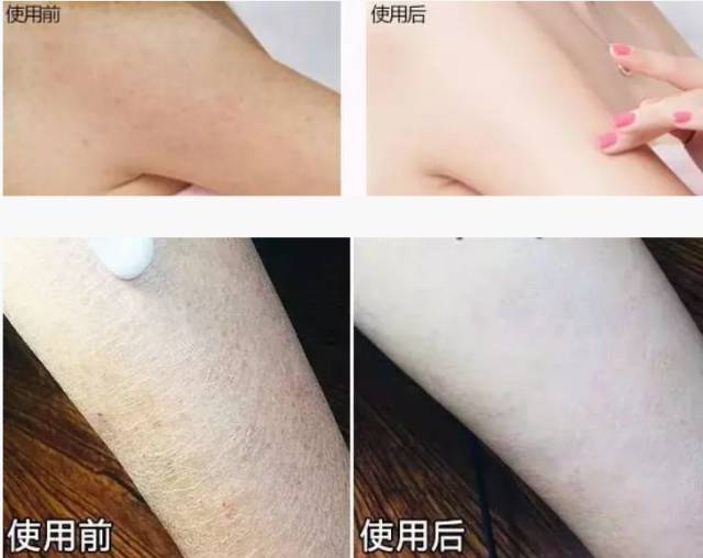 擦完身体乳长红点怎么回事(擦完身体乳长红点怎么回事儿)