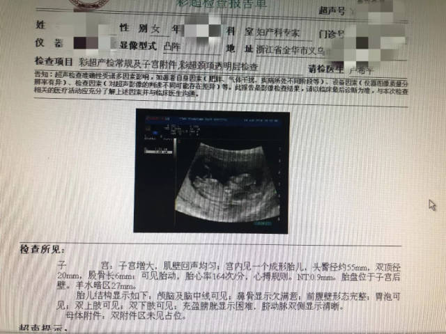 当双胎妈妈面临流产"保一流一"真的可能吗?