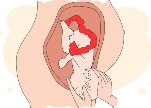 因为开得比较慢,不过开完三指之后就会很快了;有的妈妈则认为开到3指