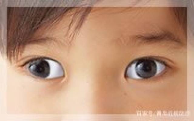 儿童的眼睛近视出现这种的情况应该怎么办