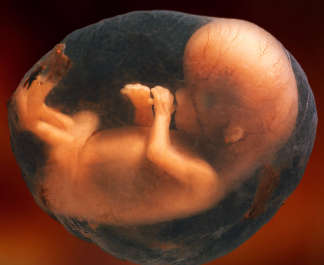 孕妇这个月,胎儿的顺产还是剖腹产基本就定了,妈妈们来看看