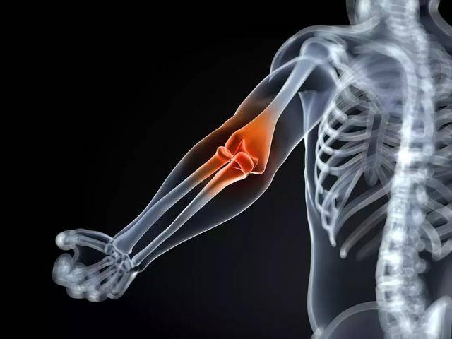肘关节外侧疼痛肱骨外上髁炎也称网球肘