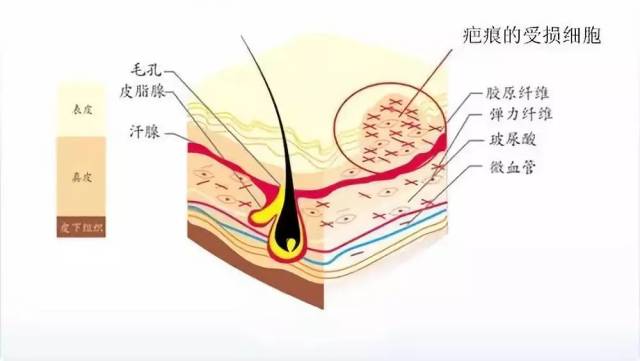 lamer起风波? 皮肤科医生说,修复疤痕的事实是这样的