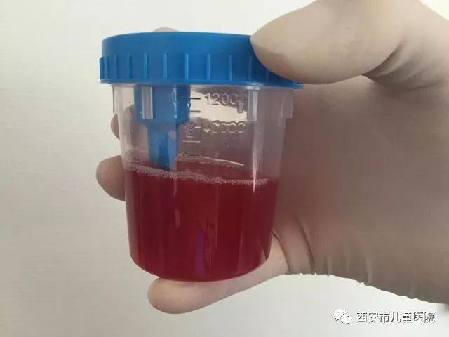 火龙果血尿图片
