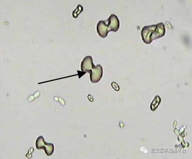 草酸钙簇晶显微图片图片