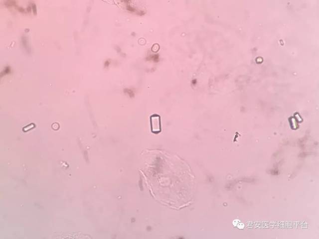 我可以方,也可以圆,但我还是我——形态多变的草酸钙结晶