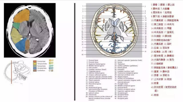 头颅ct解剖层次结构图图片