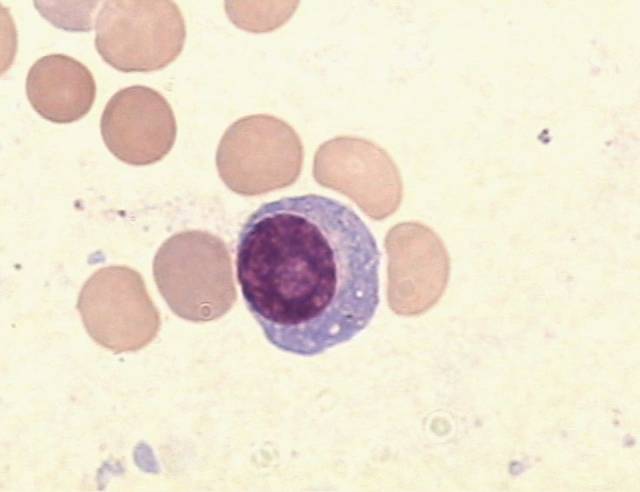 浆细胞图片显微镜图片