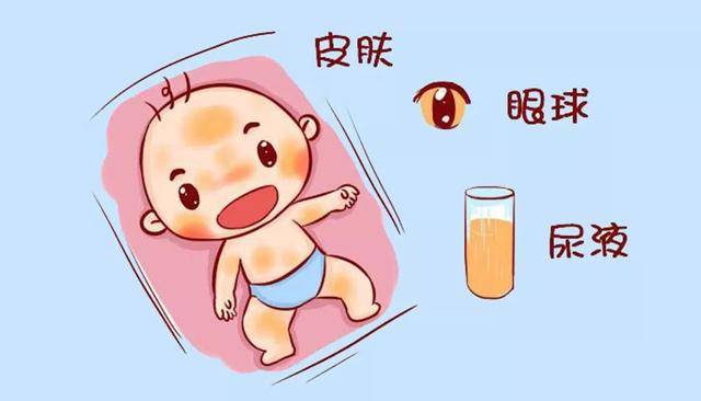 宝宝黄疸,竟有可能是母乳惹的祸?