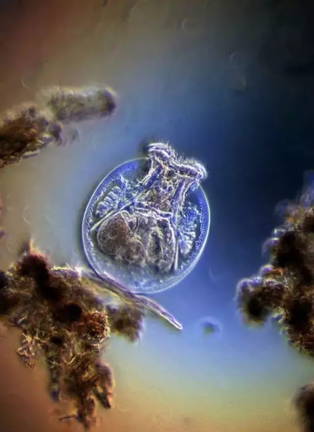 10种水中常见的细菌在显微镜下的样子,你真的不在意吗?