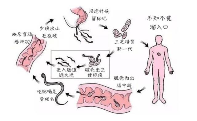 肛门——手——口的传染方式 蛲虫病的传染率很高 虽然患病的大多是