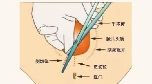 生孩子下面出口图片