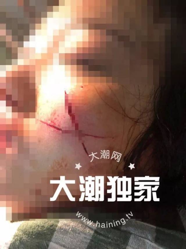 海寧一男子綁住女友用刀劃臉 又割腕自殘幾十刀!女友:我原諒他