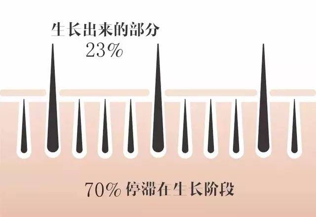 睫毛的生长期,是众多毛发中是最短的,只有短短1-3个月!