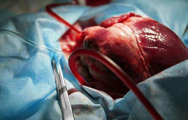 4人接受同一人的器官移植,全都患上癌症,背后的原因令人恐惧!