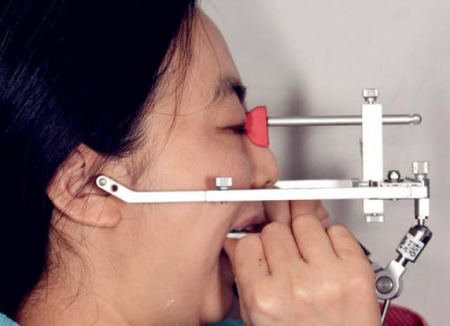 图24:基于临时修复体的面弓转移(artex )