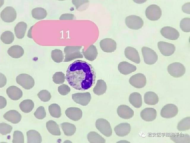 粒的中性粒细胞」 形态特征:胞体直径大约在15微米左右,圆形,胞核分3