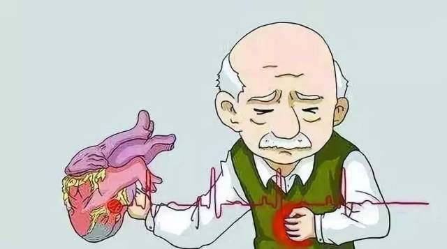 心力衰竭的必知_手机搜狐网