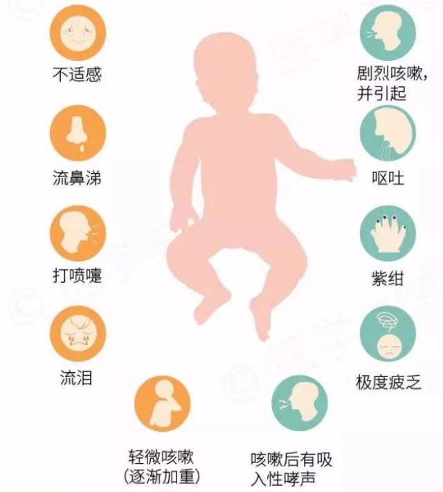 百日咳,怎么破?(内附音频,看看是不是这么咳的?