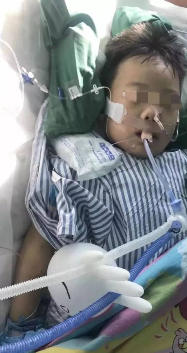 命悬一线!潍坊6岁小男孩惨遭大货车碾压,下半身多处撕脱,骨折