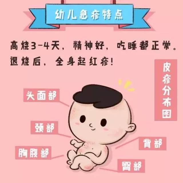 大多数宝宝都逃不掉的幼儿急疹!这样应对,让你不再受煎熬!