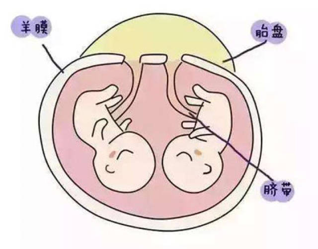 同卵双胞胎是由同一个受精卵发育而来,因此他们在性别,外貌特征,血型