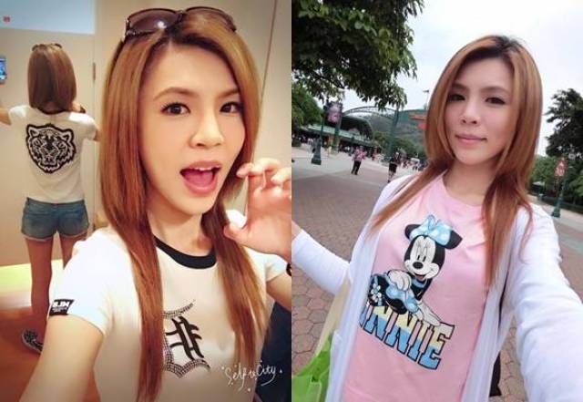 台湾女星便秘37年,曾试过3周不排便,如今要做手术切除1.5米大肠