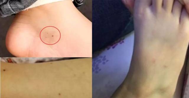 无良幼儿园全班31个孩子被针扎威胁不许告诉家长否则