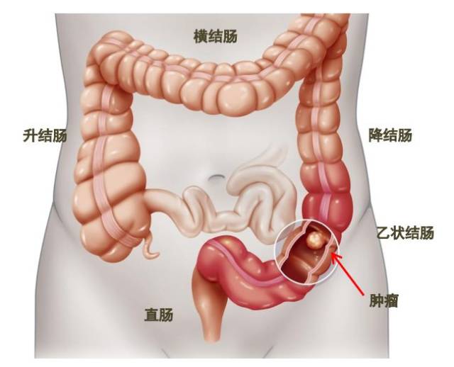 大肠的结构图 位置图图片